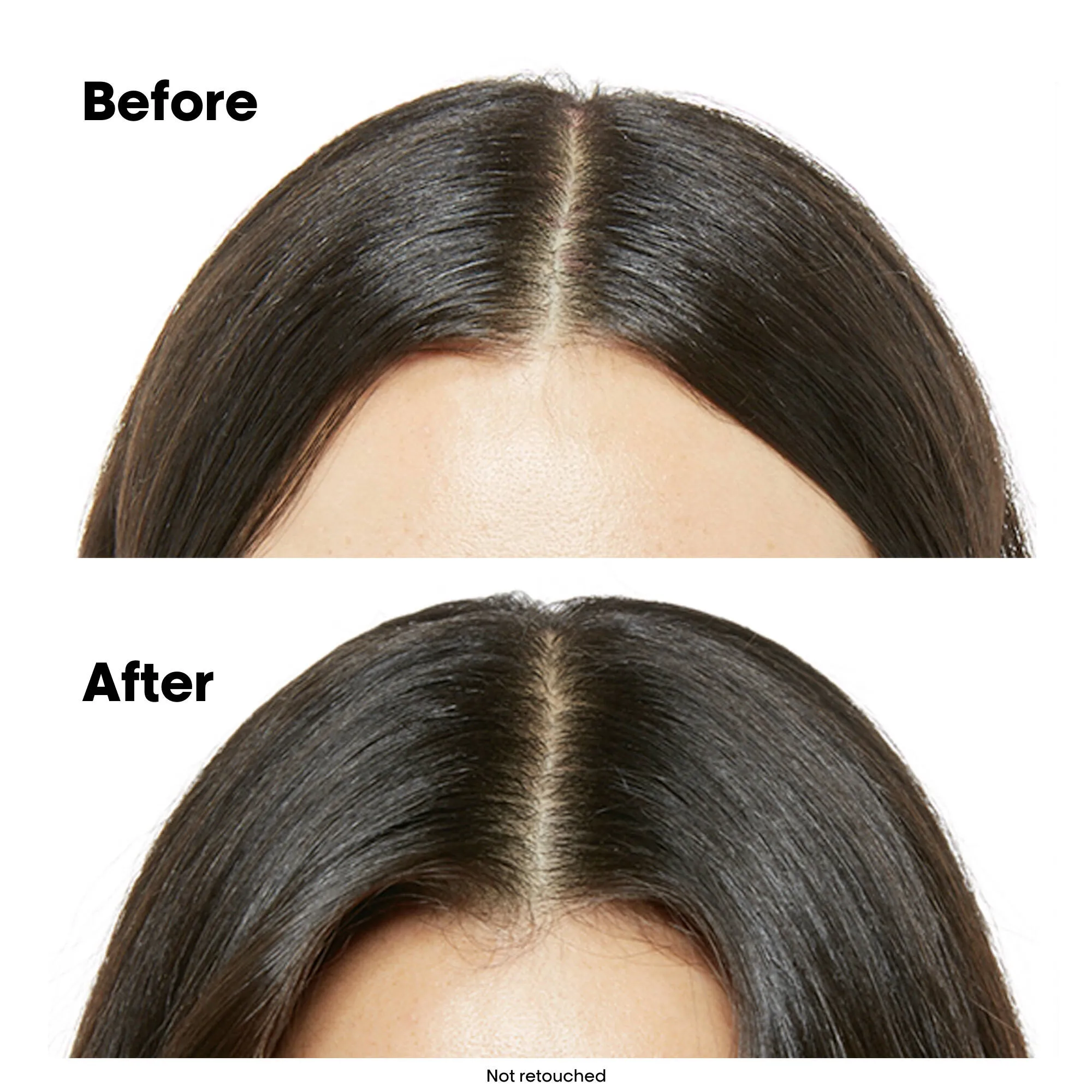 Scalp Advanced Anti-Discomfort Shampoo 500mL
