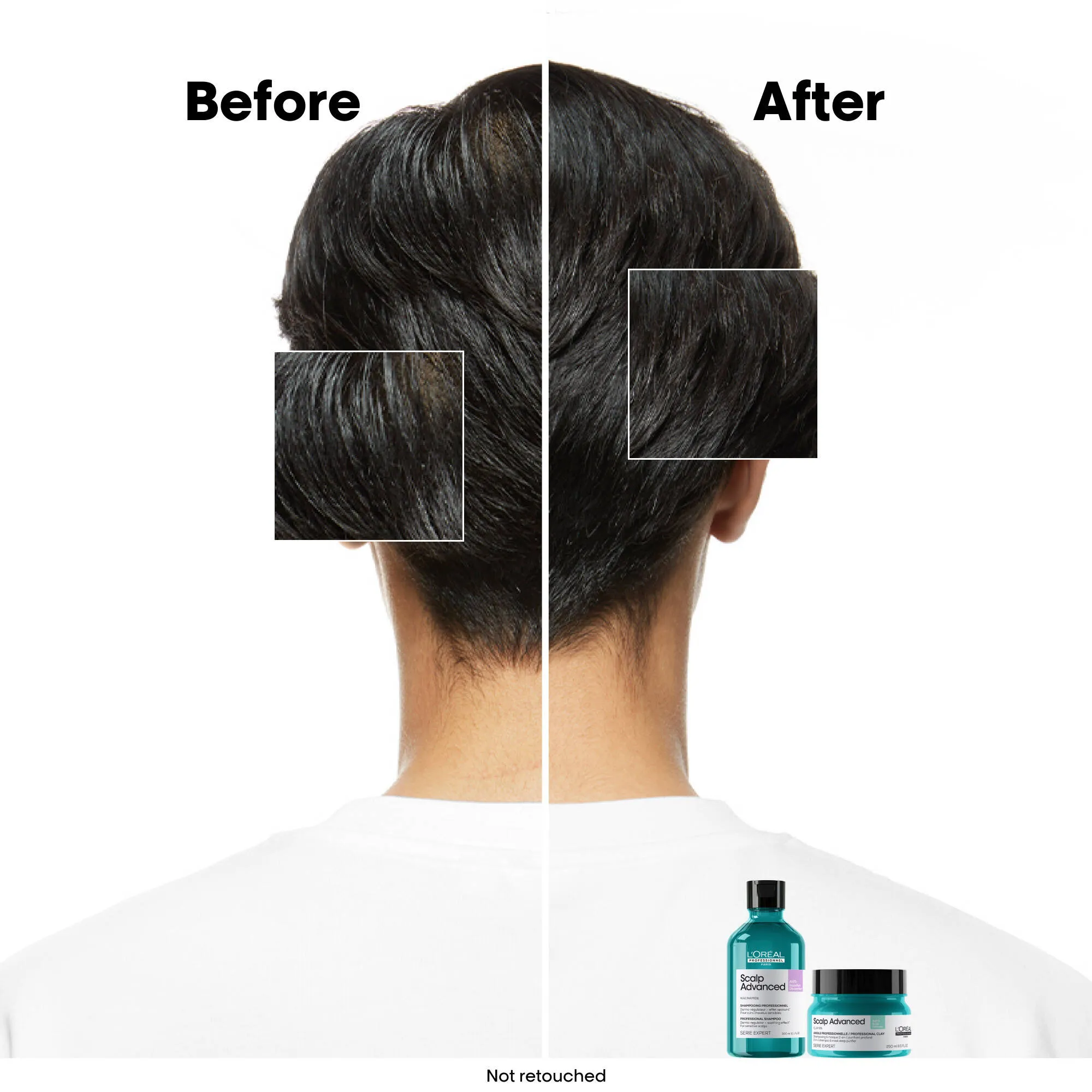 Scalp Advanced Anti-Oiliness Shampoo 500mL