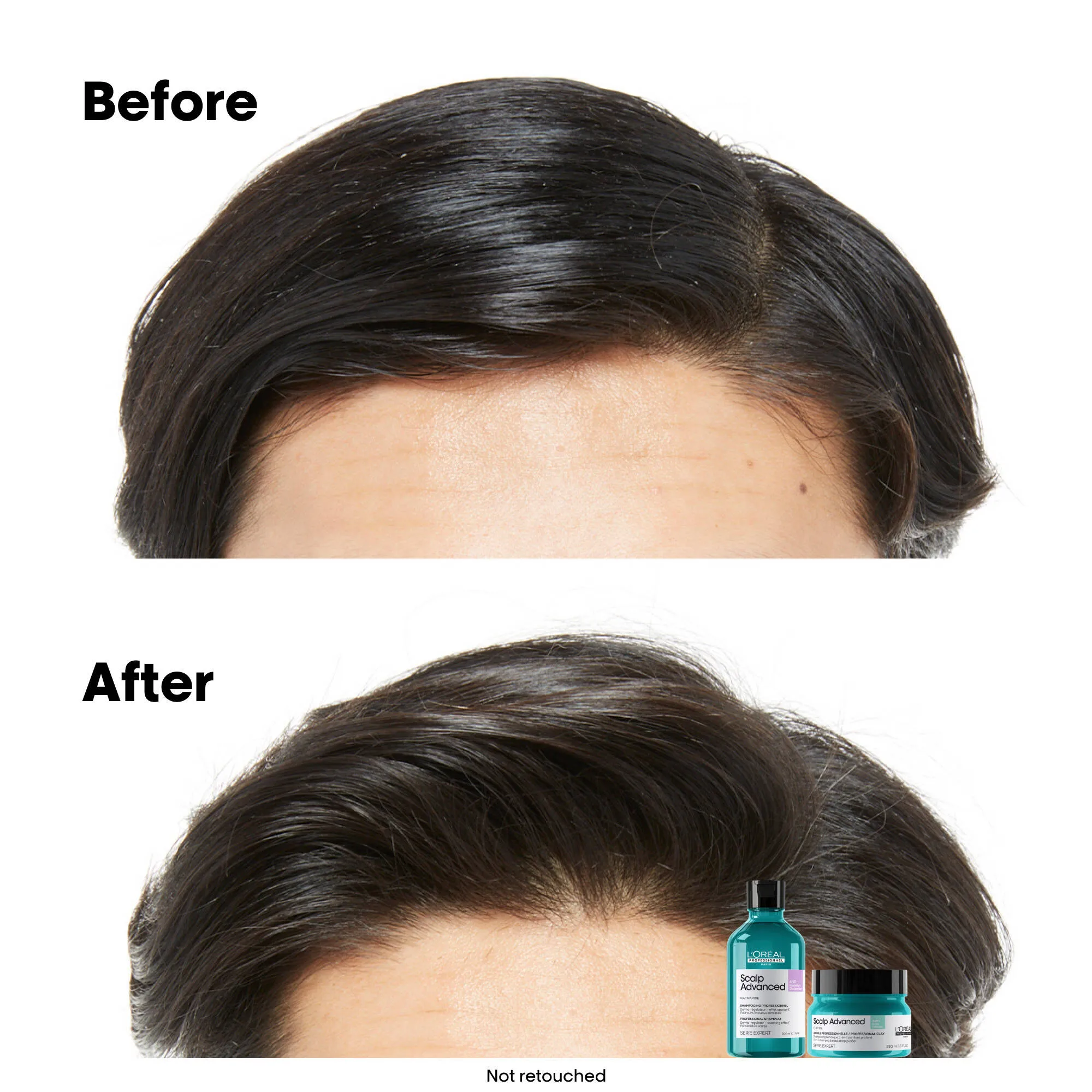 Scalp Advanced Anti-Oiliness Shampoo 500mL