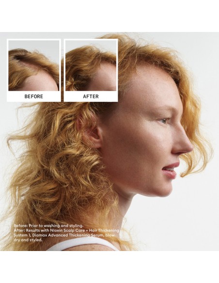 Nioxin - System 1 Kit view 8