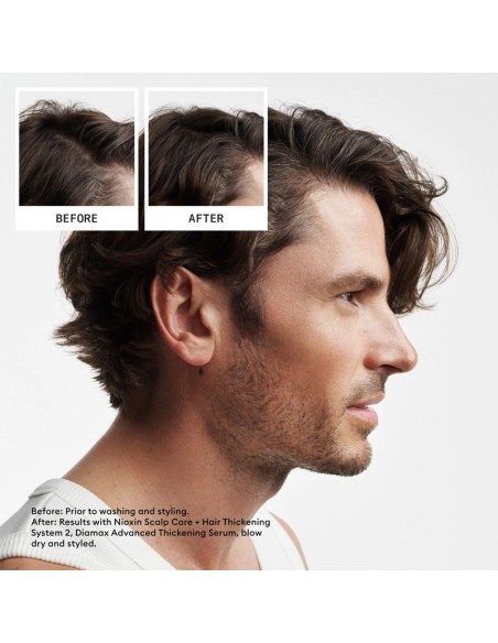 Nioxin - System 2 Kit view 8