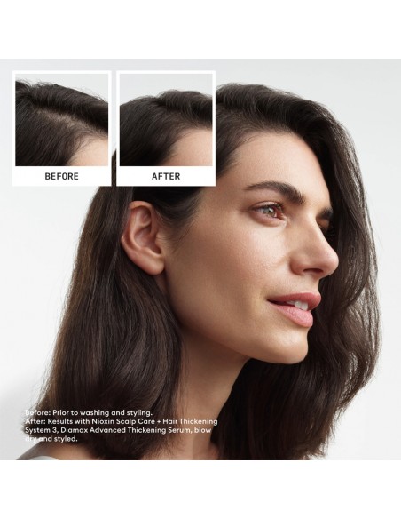 Nioxin - System 3 Kit view 7