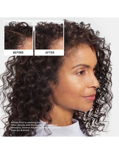 Nioxin - Ultimate Power - Hair Fall Defense Shampoo - 240ml view 7