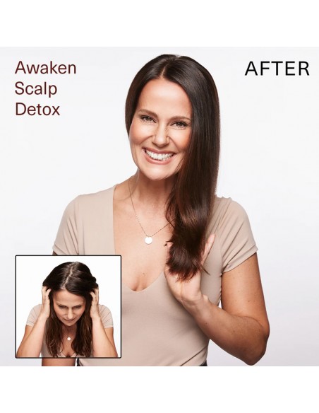 Surface - Awaken Scalp Detox - 177ml view 6