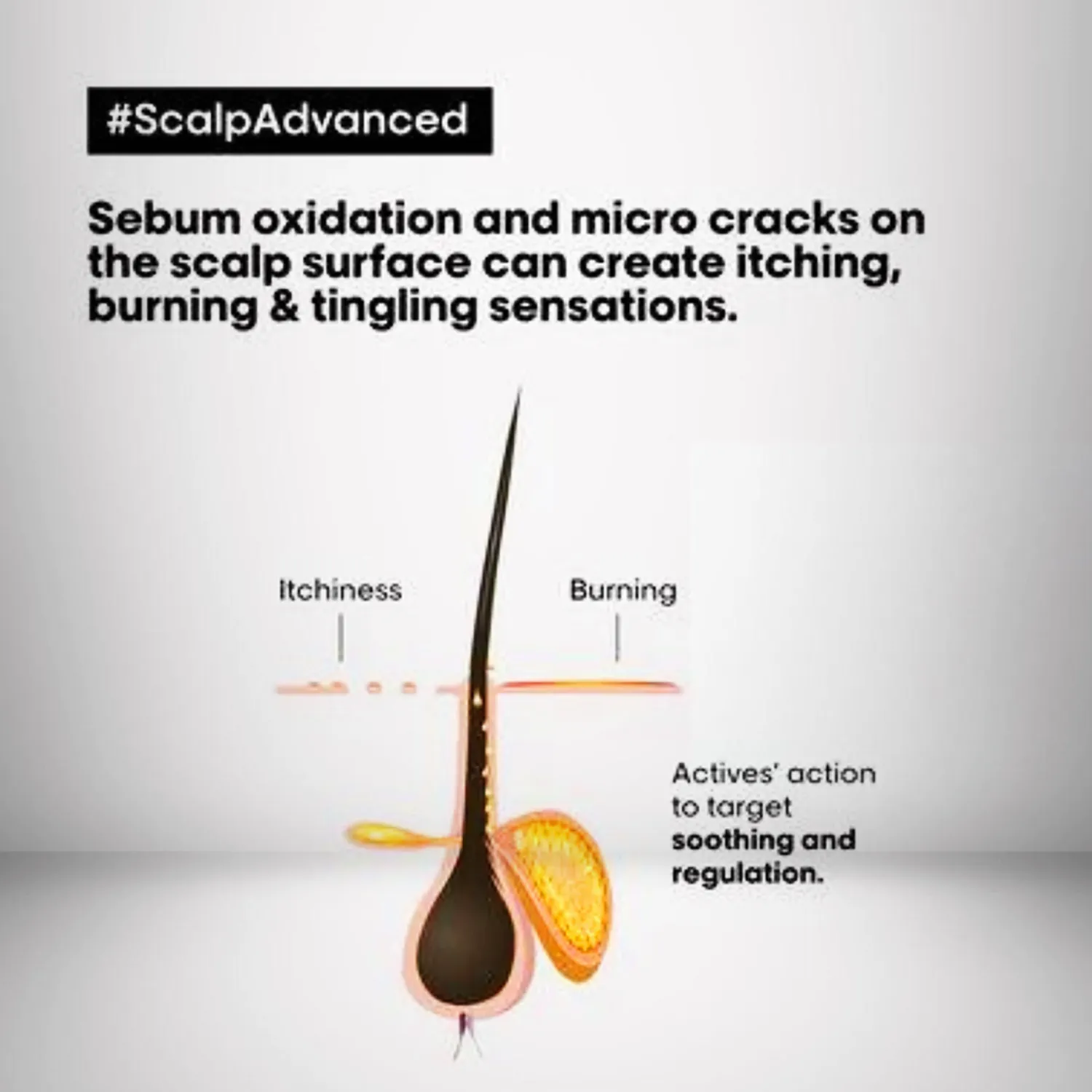 Scalp Shampoo 1.5L Advanced - View 4