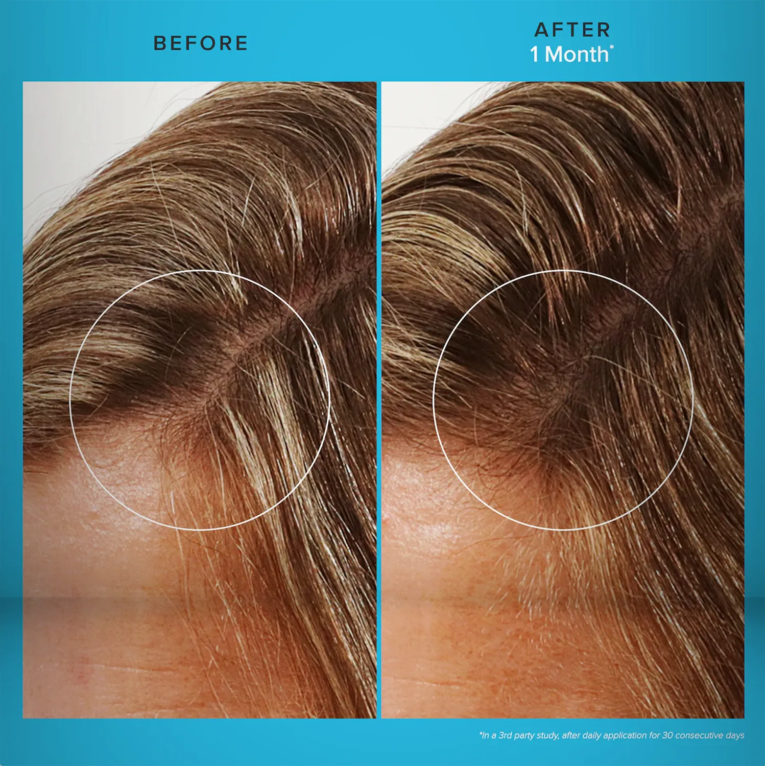 Care Treatment Revitalizing Scalp - View 2