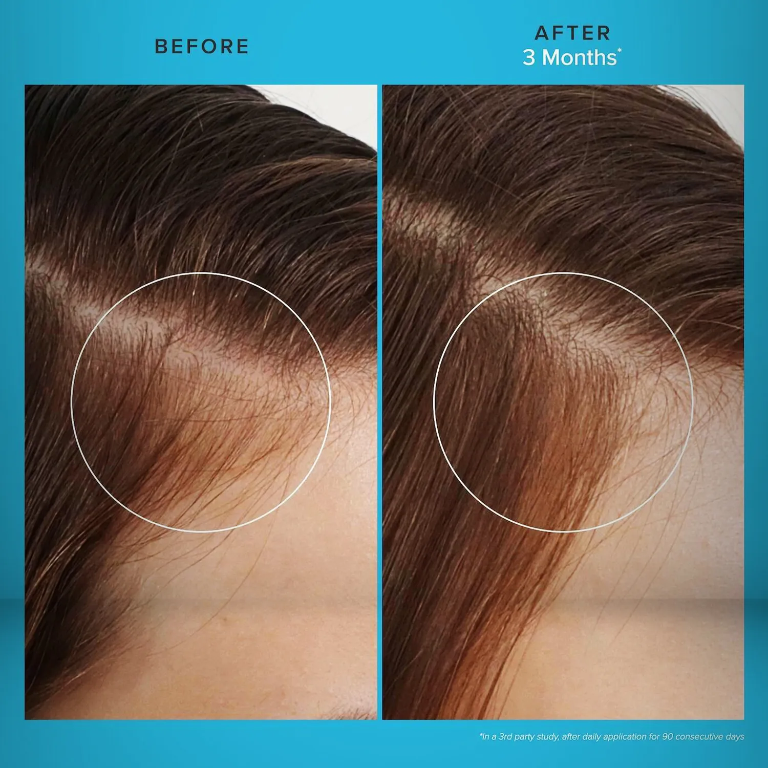 Care Treatment Revitalizing Scalp - View 4